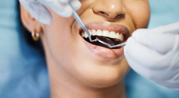 Best Pediatric Emergency Dentist in Bowling Green, MO