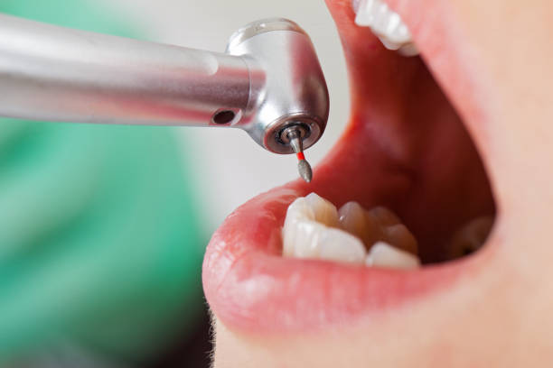 Best Weekend Emergency Dentist in Bowling Green, MO
